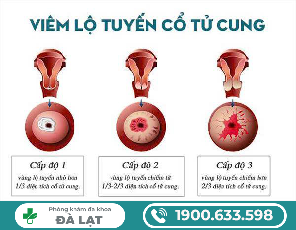 Hình ảnh minh họa